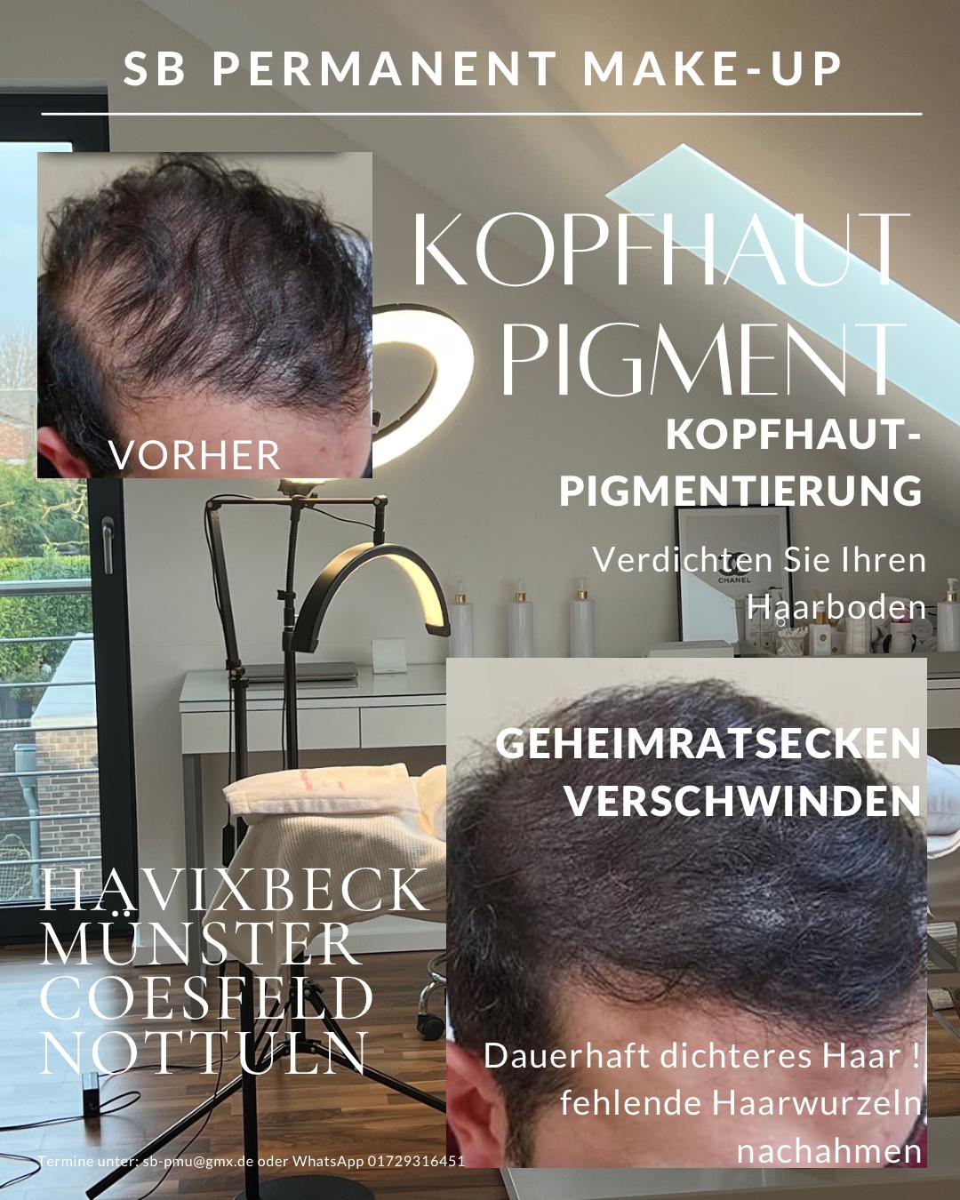 Kopfhautpigmentierung